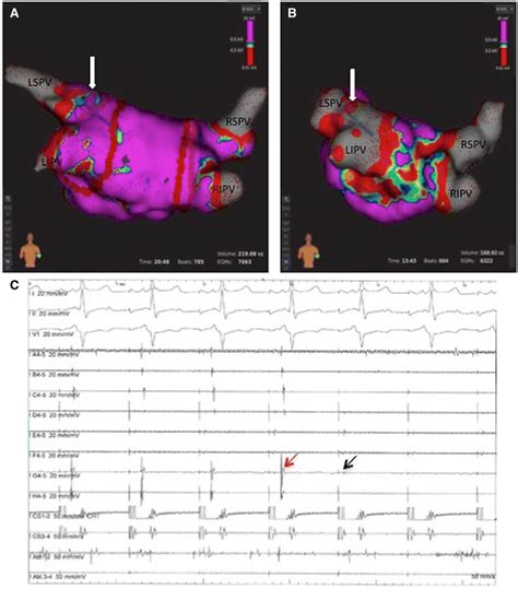 First Clinical Experience Using A Novel High Resolution