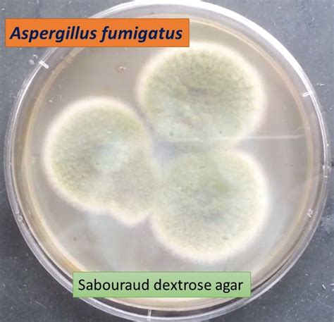 Microbe Notes Aspergillus Fumigatus On Sabouraud Dextrose Agar Sda