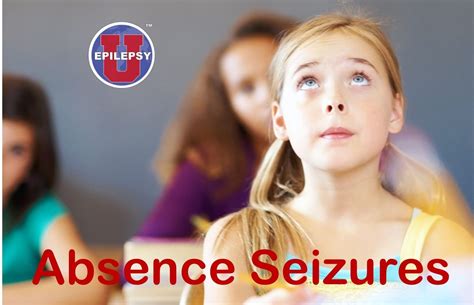 Understanding absence epilepsy - EpilepsyU