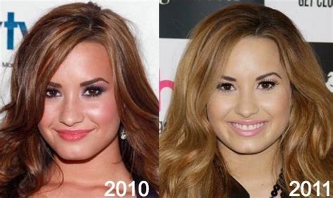 Demi Lovato before and after plastic surgery (9) – Celebrity plastic ...