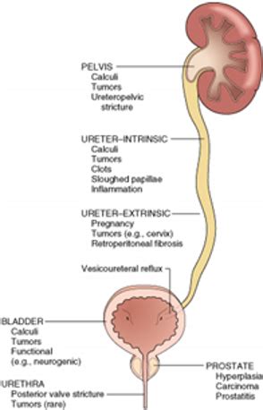 Module Alterations Of Renal And Urinary Function Flashcards Quizlet