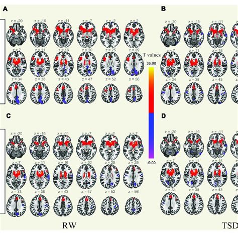 Whole Brain Functional Connectivity Patterns Of The Caudate Before