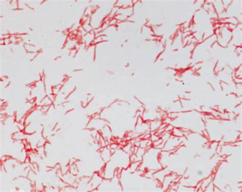 Spirochetes Definition, Characteristics, Gram Stain And, 52% OFF