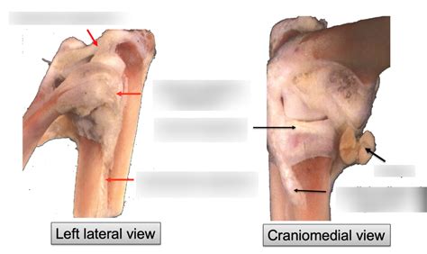 Ligaments Of The Elbow Joint Diagram Quizlet