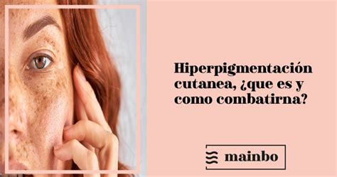 Hiperpigmentación de la piel qué es y cómo combatirla