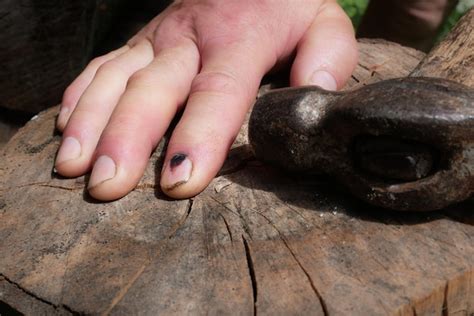 Marteau Et Doigt Humain Avec Un Ongle Meurtri Fonc Blessure Au Doigt