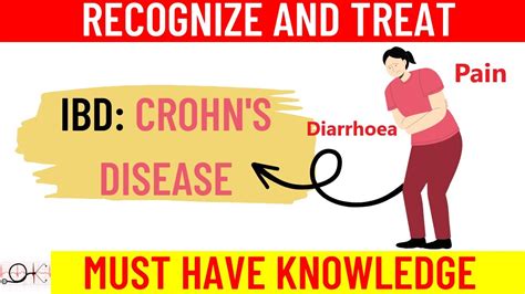 What Is Crohns Disease Ibd All You Need To Know Causes