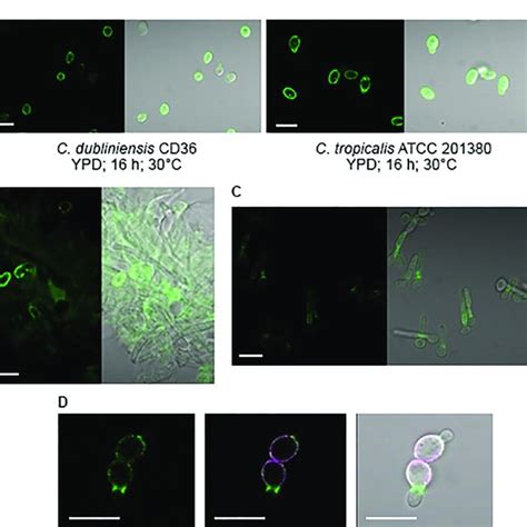 Western Blotting And Immunolabeling Of C Albicans Cells To Demonstrate