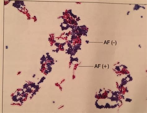 Acid Fast Stain Micro Lab Q Flashcards Quizlet