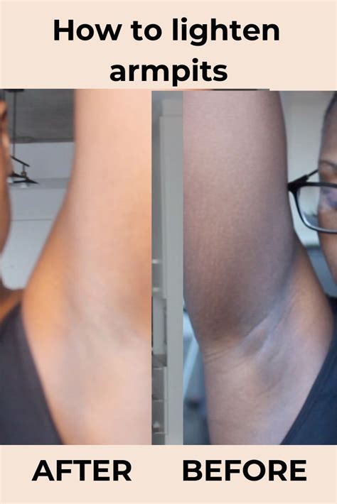 Lighten Dark Armpits In Week