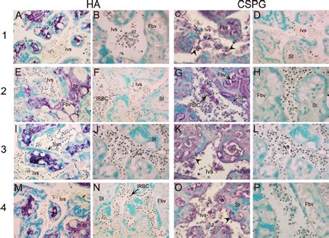 Histochemical And Immunohistochemical Analyses Of Ha And Cspg In P