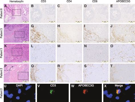 Immunohistochemistry And Immunofluorescence Of T Cell Markers In HGSOC