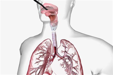bronchoscopy eremedium