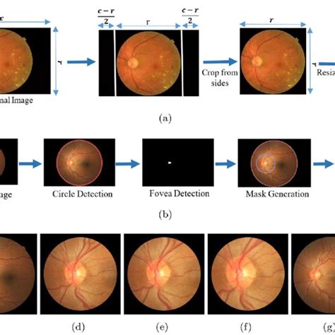 Pdf Comparison Of Smartphone Based Retinal Imaging Systems For