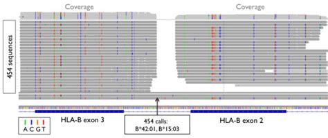 Integrative Genomics Viewer Igv Sequence Data Igv Snapshot Of