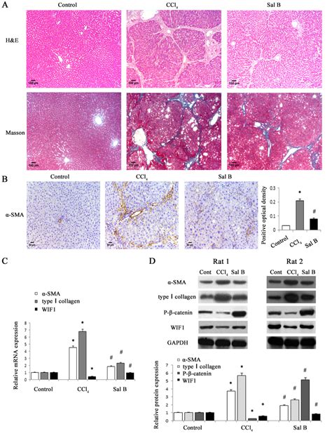 Sal B Significantly Ameliorated Ccl 4 Induced Liver Fibrosis In Rats