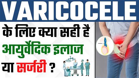 वैरीकोसेल के लिए क्या सही है आयुर्वेदिक इलाज या सर्जरी Varicocele