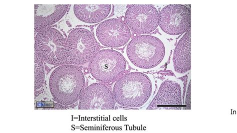 Interstitial Cells Histology