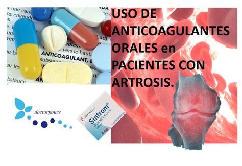 Uso De Anticoagulantes Orales En Pacientes Con Artrosis Cl Nica