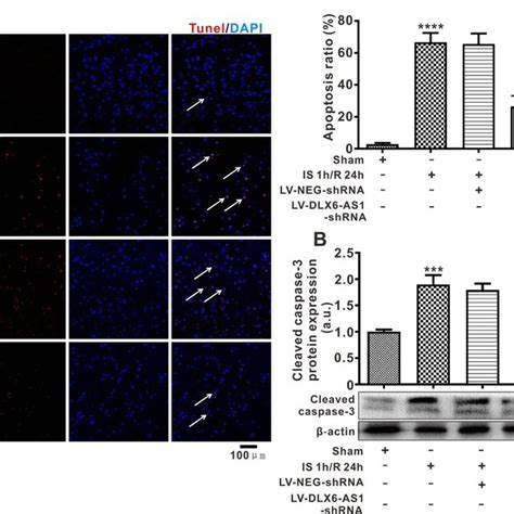 Dlx As Silencing Inhibited The Acute Injury Of Cerebral Neurons