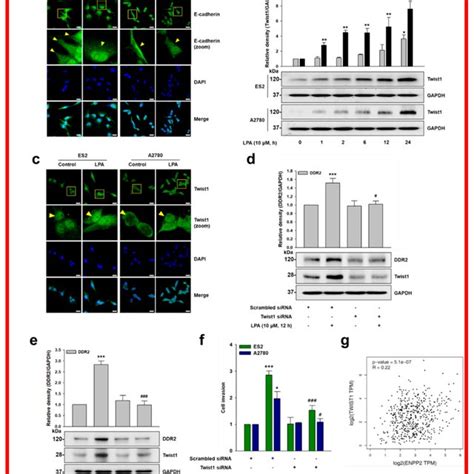 The Schematic Working Model Of Lpa Induced Ddr2 Expression And Ovarian