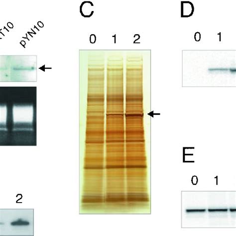 Enhanced Heterologous Expression Of H Ppase In Yeast Cells Using The