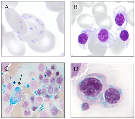 Genes Free Full Text Causes And Pathophysiology Of Acquired