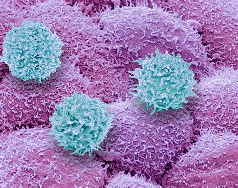 The Race To Supercharge Cancer Fighting T Cells Science Metro