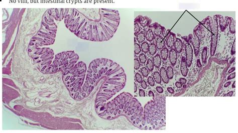 Large Intestine Colon Histology Diagram Quizlet