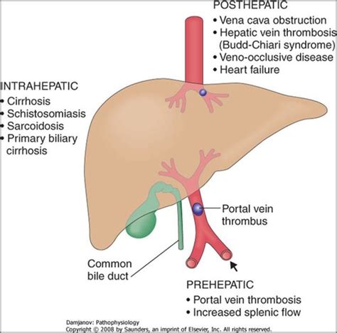 Liver And Biliary System Dysfunction Flashcards Quizlet