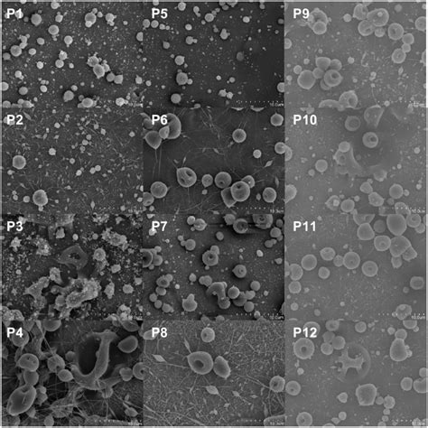 Sem Micrographs Of The Formulations Prepared By Ehdp For The Design Of