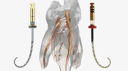 Nickel Titanium Rotary Instruments Endodontic Partners