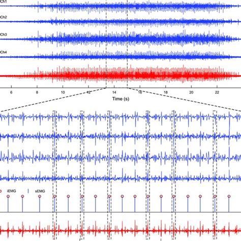 Fig A2 Intramuscular And Surface Emg Signals And Identified Spike