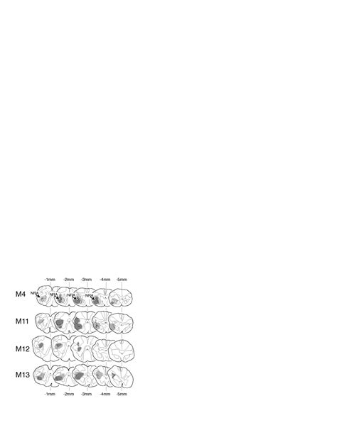 Projections from estrogen receptor α immunoreactive neurons in the