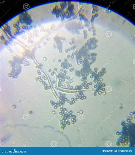 Penicillium Genus Mold Fungal Spores Mycelium Under the Microcope Stock ...