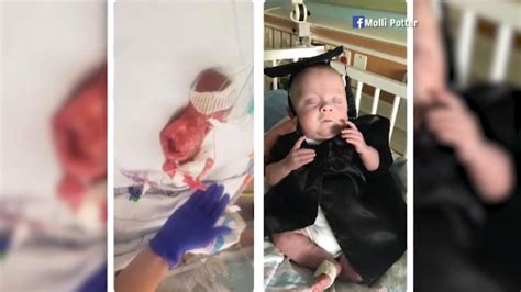 Baby Born At 22 Weeks ‘graduates From Nicu Complete With Cap And Gown