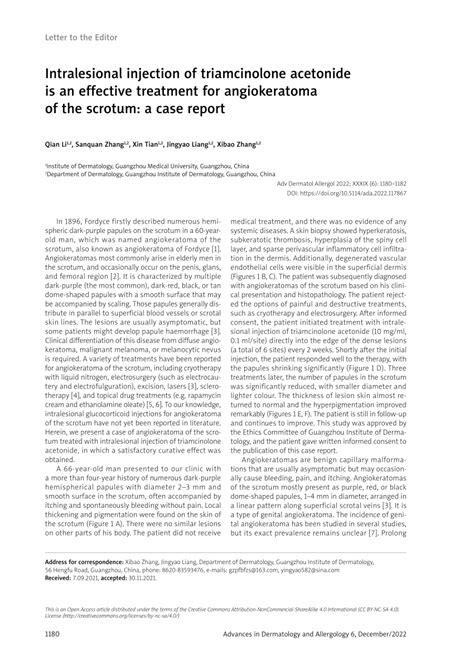 Pdf Intralesional Injection Of Triamcinolone Acetonide Is An