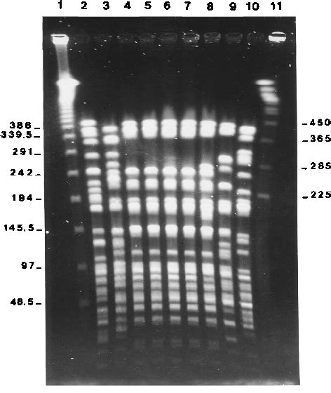 Analysis Of XbaI Digested DNA By PFGE DNA Was Prepared From Clinical