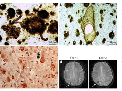 Amyloid beta-Protein Precursor | Semantic Scholar