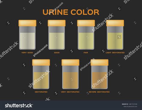 Urine Color Vector Transparent Yellow Orange Stock Vector Royalty Free