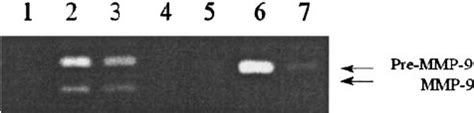 Osteopontin Induces Secretion Of In Fl Ammatory Mediators From