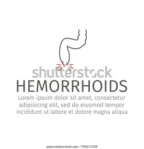 Vector Illustration Prolapsed Hemorrhoid Veins Stock Vector Royalty