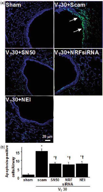 Effects Of Sn Nrf Sirna Or Neutrophil Elastase Inhibitor On Lung