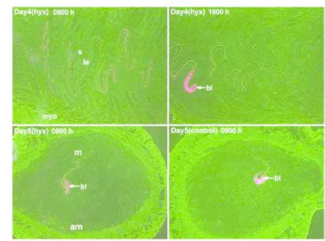 In Situ Hybridization Of Hegfl Mrna In Hypophysectomized Hyx