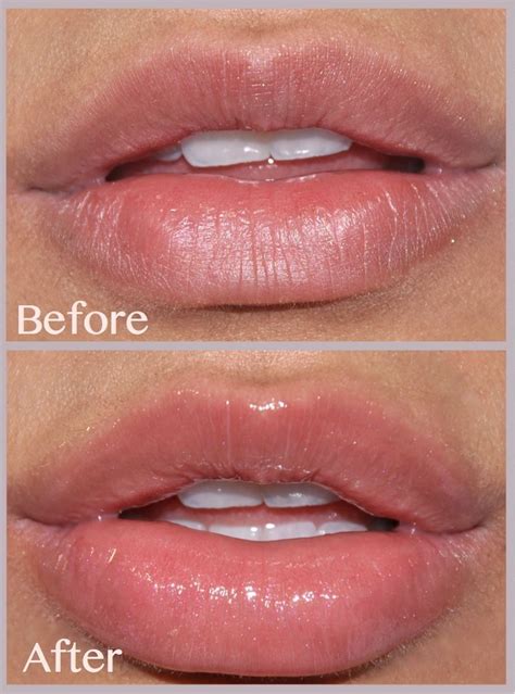 Lip Plumper Effects In 2020 Lip Plumper Plumping Lip Gloss Diy Lip