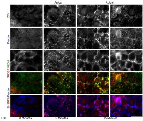 Sh Bp Is Recruited To Dorsal Ruffles Upon Egf Stimulation Of A