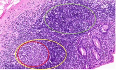 Histology Lymph Flashcards Quizlet