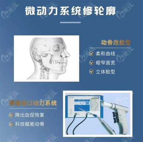 重庆刘正茂医生做轮廓手术做的好，下颌角磨骨和颧骨手术他都擅长 最热整形行业新闻话题 美佳网