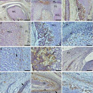 Expression Of Sox 5 Protein A L A General TMJ Image With Mandibular