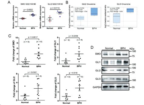 SMO And GLI1 3 Are Strongly Upregulated In BPH Tissues Compared With